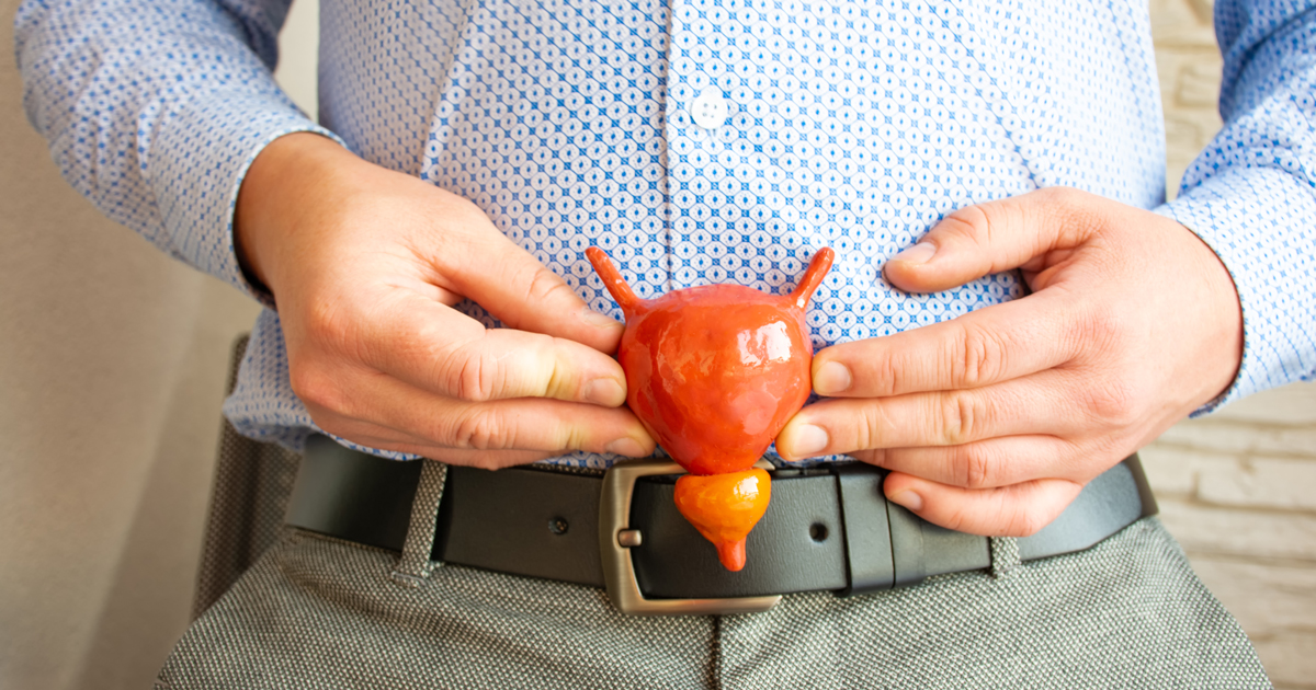 Man holding prostate replica