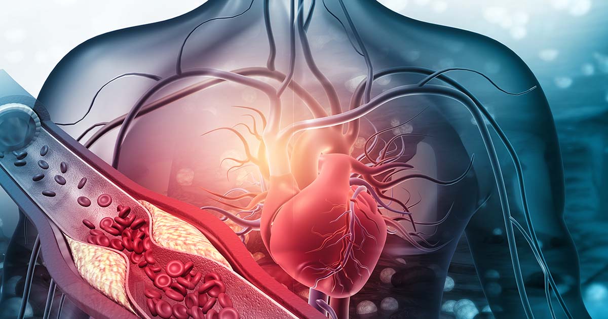 illustration of a blood clot