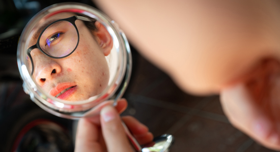 teenager looking at their face in a mirror