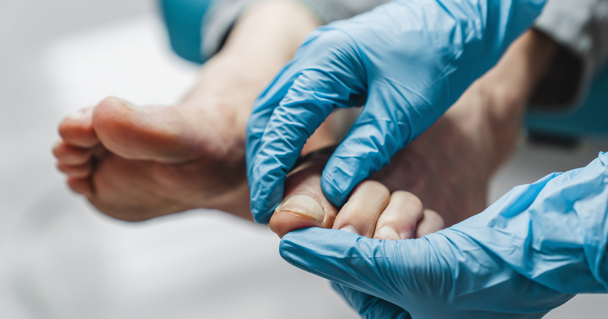 Gloved hands inspecting toenail