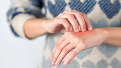 How do I know if I have Psoriasis or Eczema?