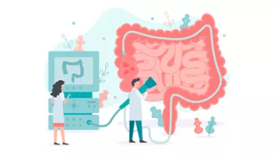 colonoscopy illustration