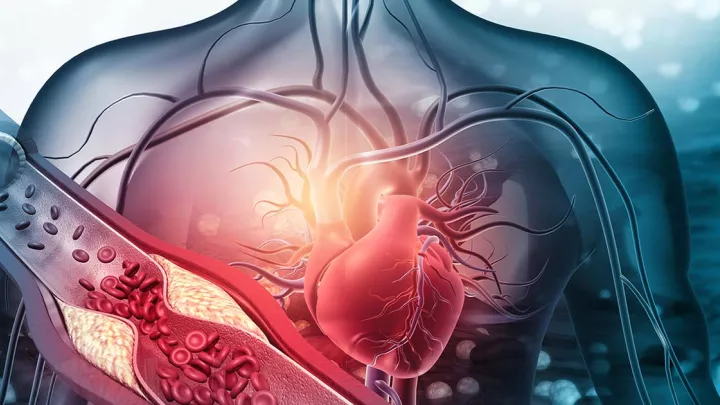 illustration of a blood clot