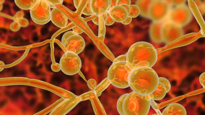 Medical image of Candida auris
