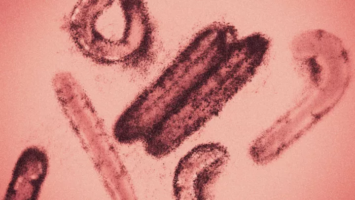 Colored visualization of Marburg virus electron microscopy photo