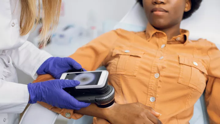 Doctor evaluating a mole on a patient's skin